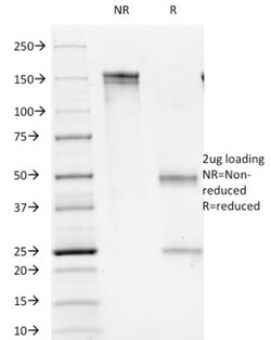 Mouse anti-Fc gamma RIIIA/CD16a, Clone: C16/1045, Novus Biologicals:Antibodies:Primary